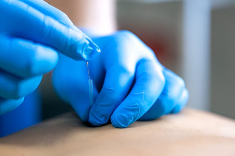 Is EPTE effectief? Wat een overzicht van alle studies laat zien