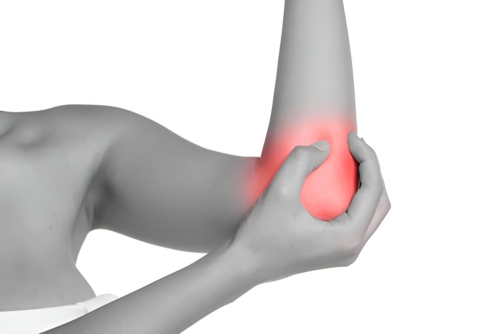 Carpaletunnelsyndroom: radiale shockwave vermindert pijn en tintelingen