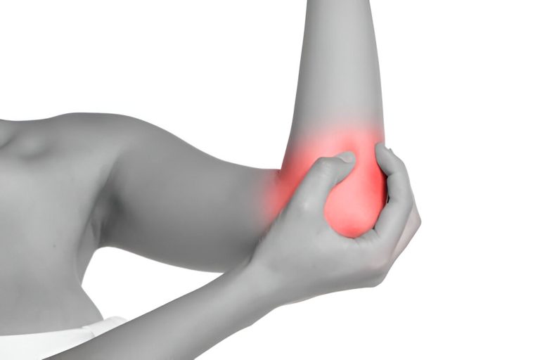Carpaletunnelsyndroom: radiale shockwave vermindert pijn en tintelingen