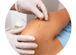 Dry needling