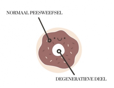 Het donutmodel van peesweefsel